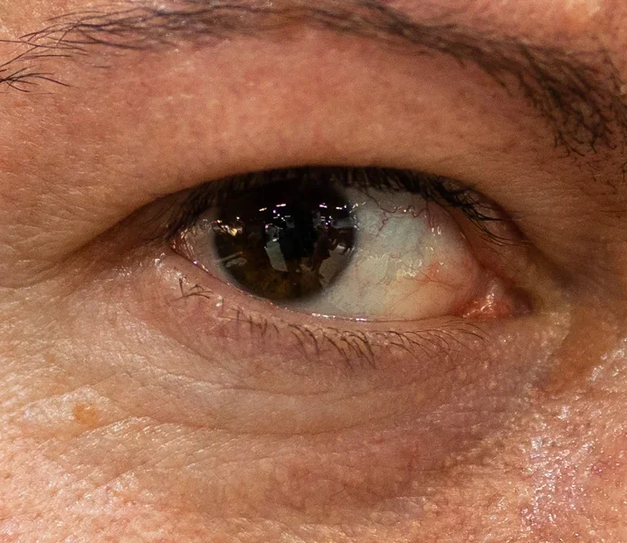 Auge.webp