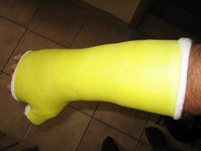 Gips.jpg